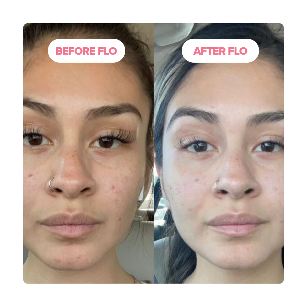 FLO - Period Relief Gummy Vitamins - Image 6